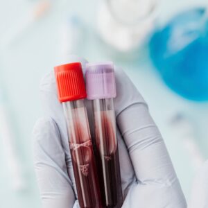 Webinar: Blut und Blutprodukte update