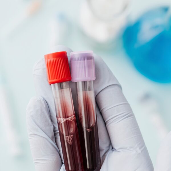 Webinar: Blut und Blutprodukte update